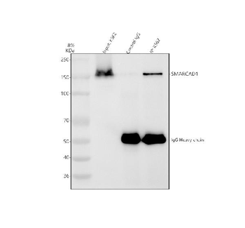 SMARCAD1 Antibody