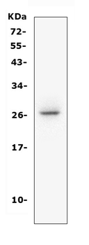 CD160 Rabbit Polyclonal Antibody