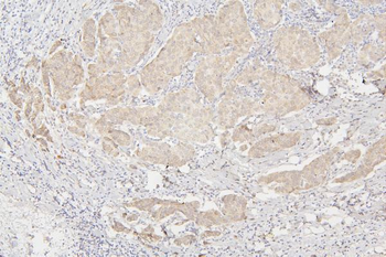 Semaphorin 3B/SEMA3B Antibody