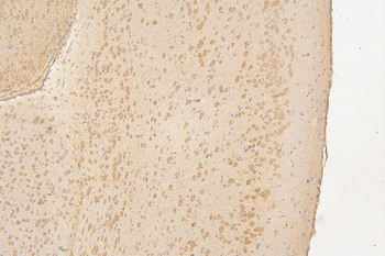 Semaphorin 3B/SEMA3B Antibody