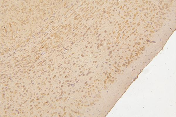 Semaphorin 3B/SEMA3B Antibody
