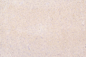 Semaphorin 3B/SEMA3B Antibody