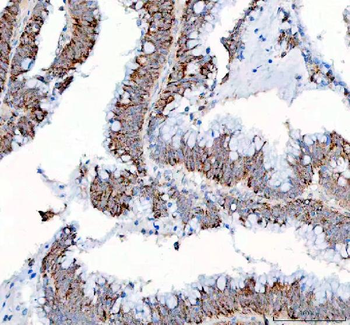 PPA2 Antibody
