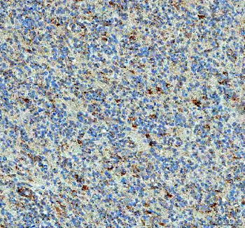 PPA2 Antibody