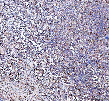 PPA2 Antibody