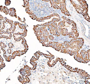 PPA2 Antibody