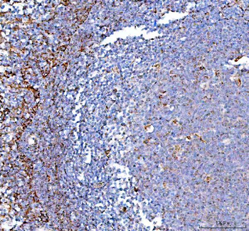 PPA2 Antibody