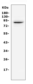 Semaphorin 3E/SEMA3E Rabbit Polyclonal Antibody