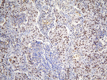 TAF12 Rabbit Polyclonal Antibody