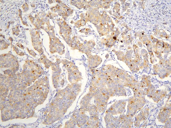 TAF12 Rabbit Polyclonal Antibody
