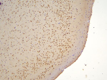 TAF12 Rabbit Polyclonal Antibody