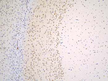 TAF12 Rabbit Polyclonal Antibody