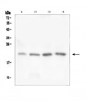 TAF12 Rabbit Polyclonal Antibody