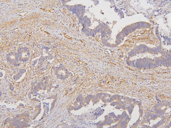 RAB3GAP2 Antibody