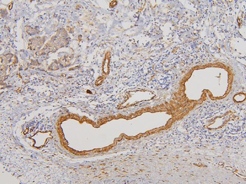 RAB3GAP2 Antibody