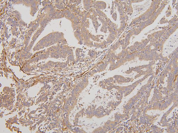 RAB3GAP2 Antibody