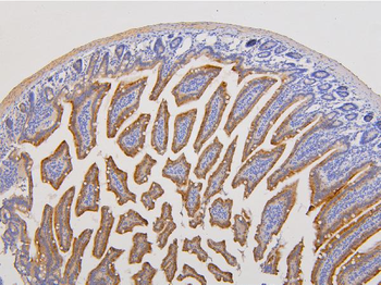 RAB3GAP2 Antibody