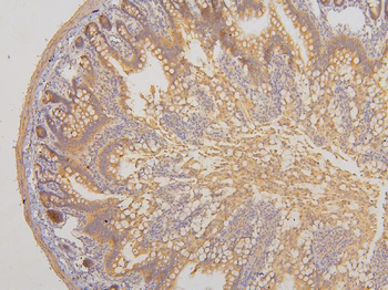 RAB3GAP2 Antibody