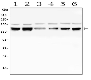 RAB3GAP2 Antibody