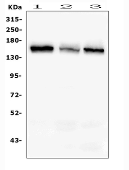 RAB3GAP2 Antibody
