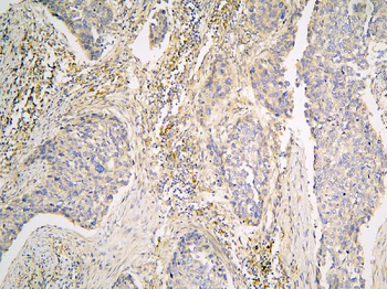 Pyrophosphatase 1/PPA1 Antibody