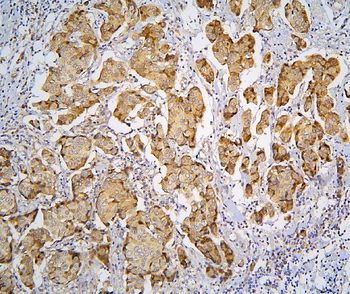 Pyrophosphatase 1/PPA1 Antibody