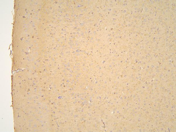 Pyrophosphatase 1/PPA1 Antibody