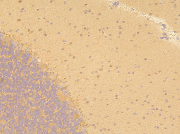Pyrophosphatase 1/PPA1 Antibody