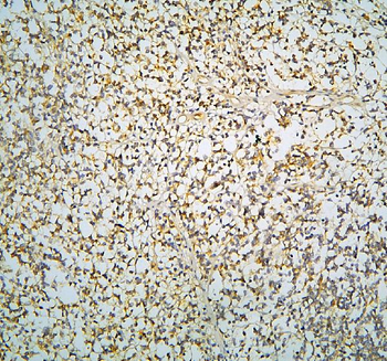 R-Cadherin-4 CDH4-/CDH4 Rabbit Polyclonal Antibody