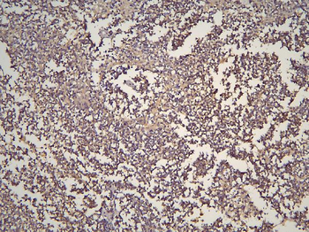 HOOK3 Antibody