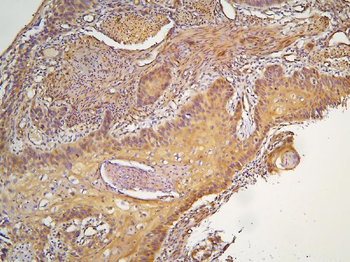HOOK3 Antibody