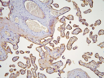 HOOK3 Antibody