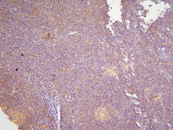 HOOK3 Antibody