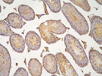HOOK3 Antibody