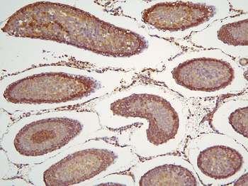 HOOK3 Antibody