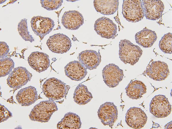 DAZAP1 Rabbit Polyclonal Antibody