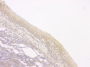 SRCIN1 Antibody