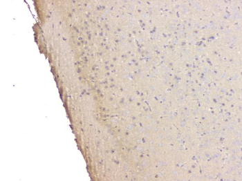 SRCIN1 Antibody