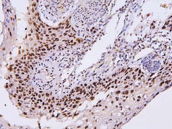 BHC80/PHF21A Antibody
