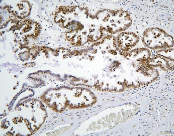 BHC80/PHF21A Antibody