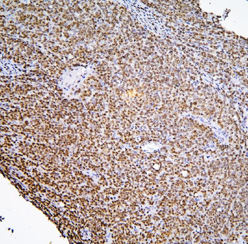 BHC80/PHF21A Antibody