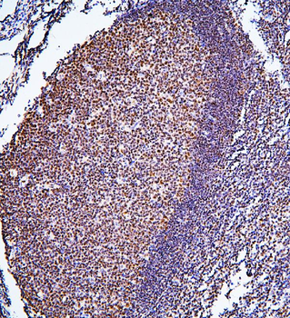 BHC80/PHF21A Antibody