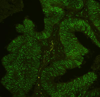 BHC80/PHF21A Antibody