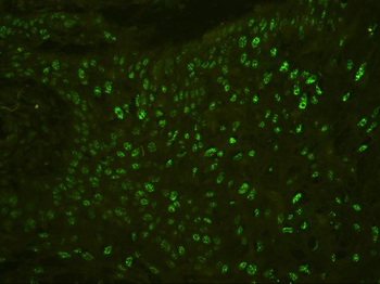 BHC80/PHF21A Antibody