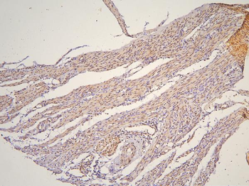 BHC80/PHF21A Antibody