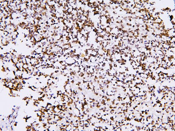 BHC80/PHF21A Antibody