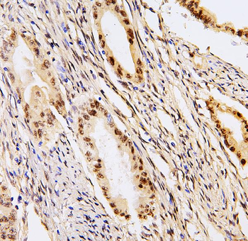 BHC80/PHF21A Antibody