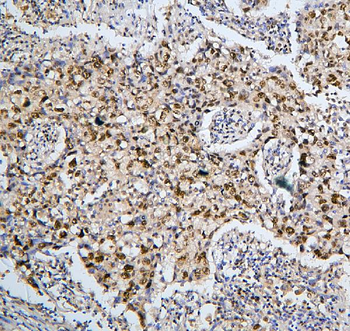 BHC80/PHF21A Antibody