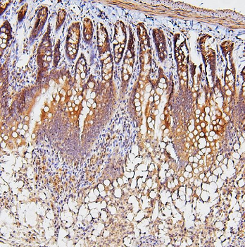 TDRD3 Rabbit Polyclonal Antibody