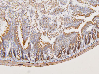 ATP5G1,2,3/ATP5MC1,2,3 Antibody